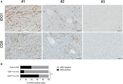 IDO Targeting in Sarcoma: Biological and Clinical Implications